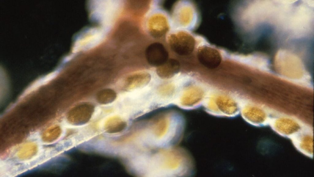 Some Seafood Toxins Endure Cooking—And They're Causing Foodborne Illnesses