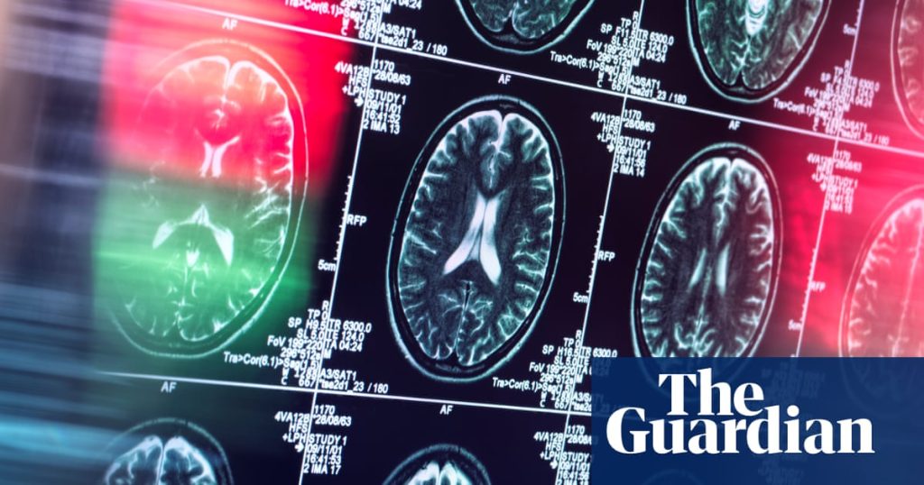 Study suggests antidepressants and antipsychotics may be alternatives to opioids