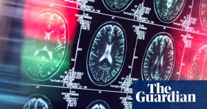Study suggests antidepressants and antipsychotics may be alternatives to opioids