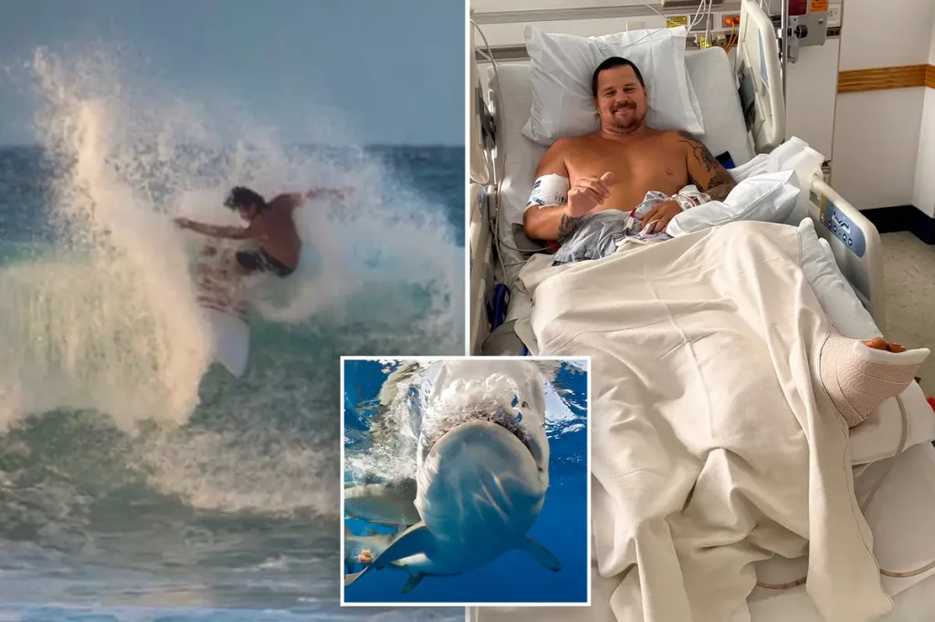 Surfer recounts how an 8-foot shark tore into his legs: 'My calf is almost completely open'