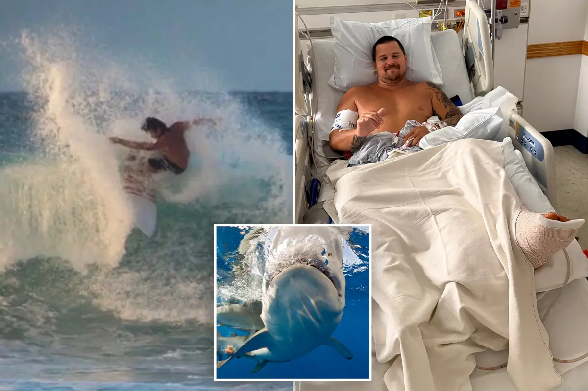 Surfer recounts how an 8-foot shark tore into his legs: 'My calf is almost completely open'