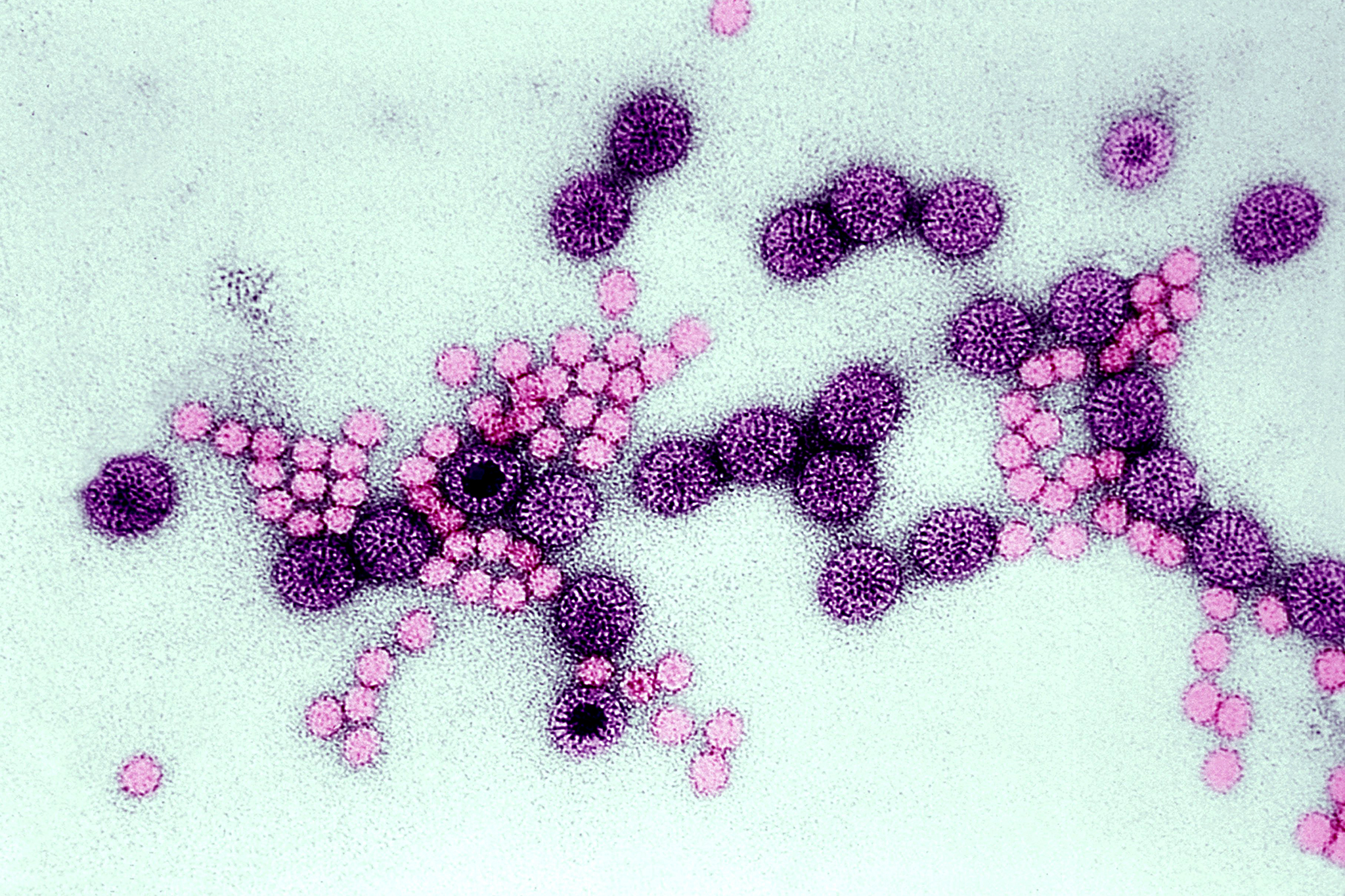 Surge in highly contagious rotavirus cases in Bay Area following World Cup kickoff