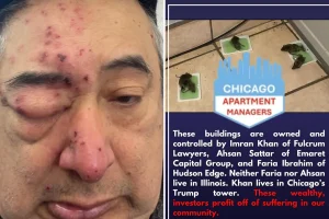 Tenant in Chicago reports waking up to rats biting his face