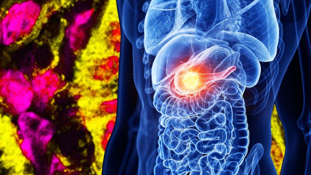The Cancer Research Program Trump Is Undermining Just Achieved a Major Breakthrough