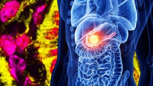 The Cancer Research Program Trump Is Undermining Just Achieved a Major Breakthrough