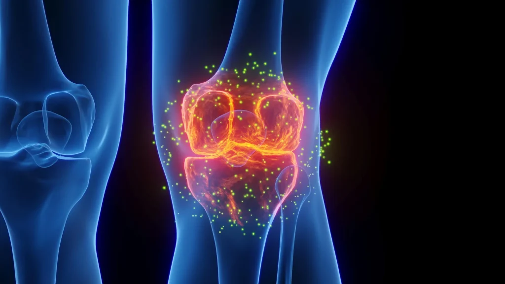 This new therapy is assisting individuals in preventing knee replacement surgery.
