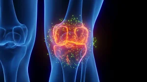 This new therapy is assisting individuals in preventing knee replacement surgery.