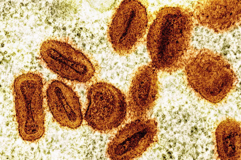 Two scientists accused of illegally bringing a deactivated mpox virus into the US