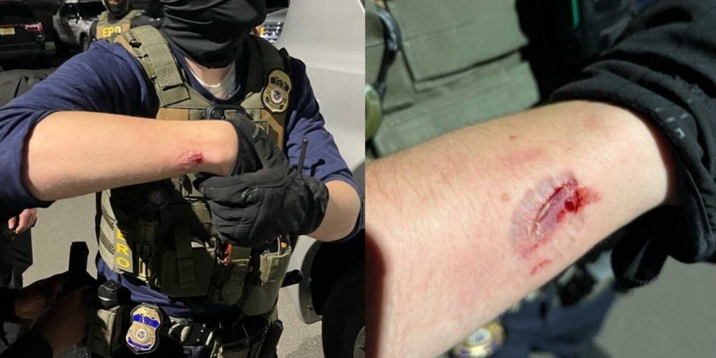 'Violent protester' brutally bit ICE agent during New Jersey riots, according to DHS