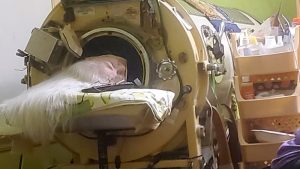 Martha Lillard, the final US polio patient reliant on an iron lung, passes away at 78 in Oklahoma.