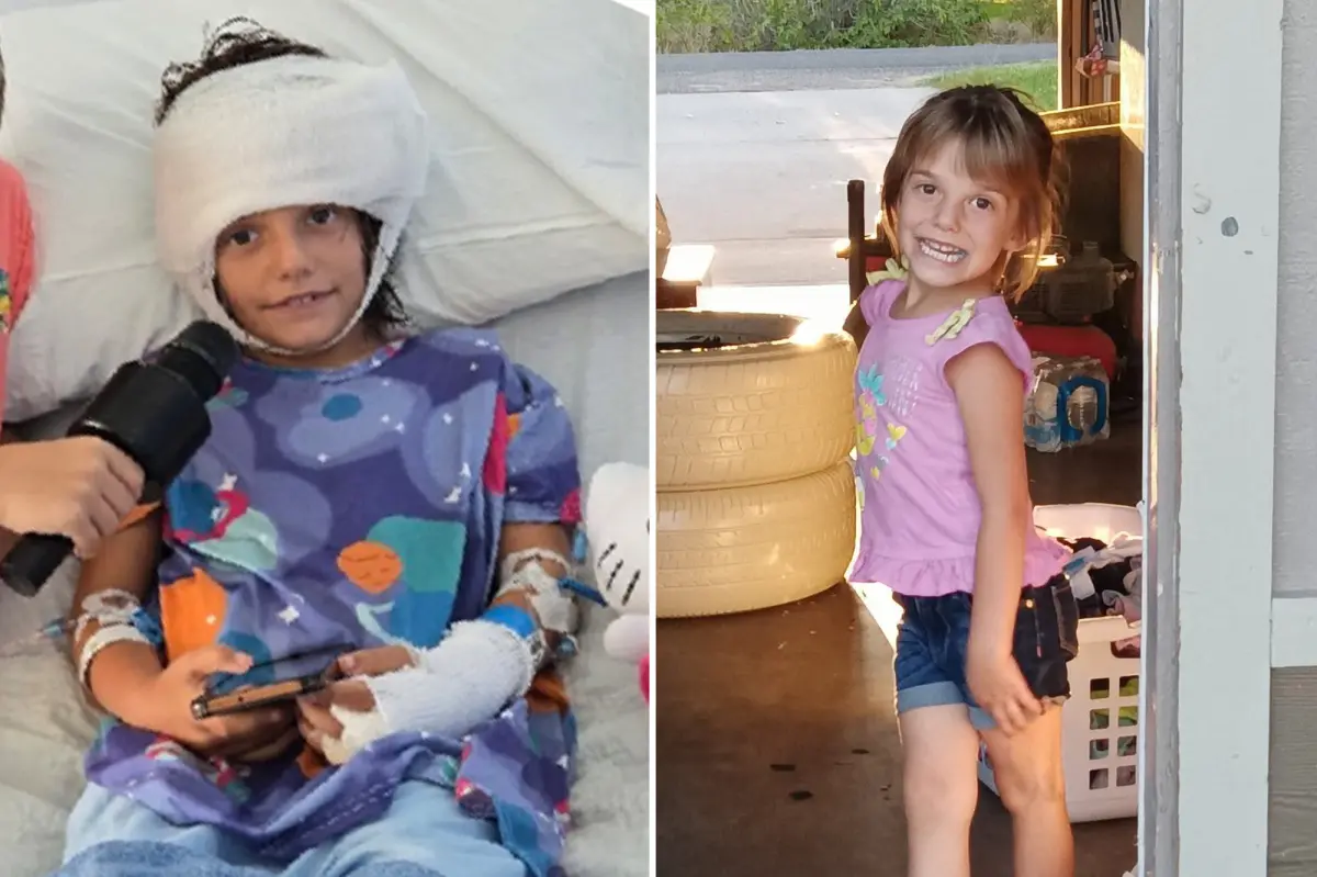 7-year-old girl in California battling for her life after dogs tear off her scalp and injure her legs