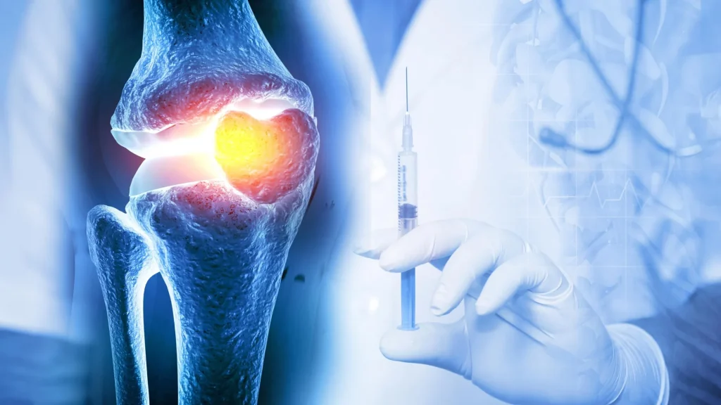 A single injection reversed osteoarthritis in just weeks.