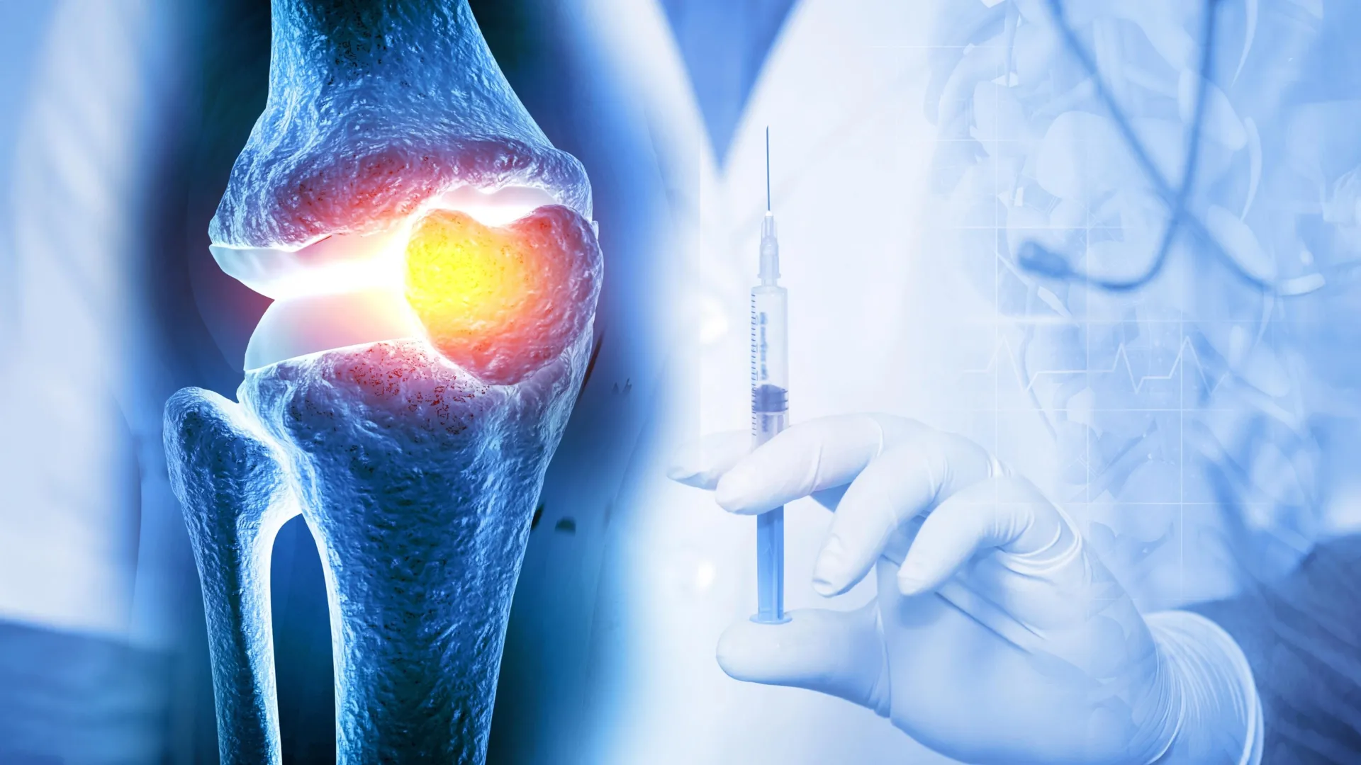 A single injection reversed osteoarthritis in just weeks.
