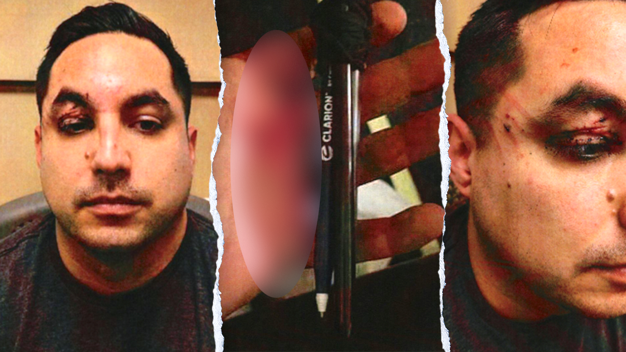 Airline passenger confesses to creating pen weapon prior to violent eye assault during flight