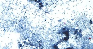 Almost 600 instances of Cyclosporiasis recorded in Michigan on Independence Day.