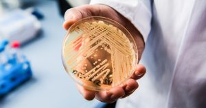 Drug-resistant fungus Candida auris continues to increase in the U.S.