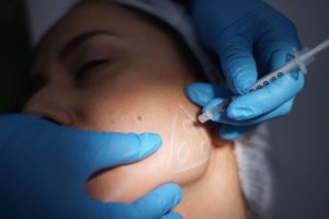 I received 12 vials of Botox in my face at 24, but it wasn’t about my appearance.