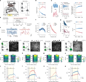 Improving cortical disinhibition enhances symptoms of Huntington's disease