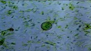 Over 60 cases in North Carolina linked to parasite causing severe diarrhea