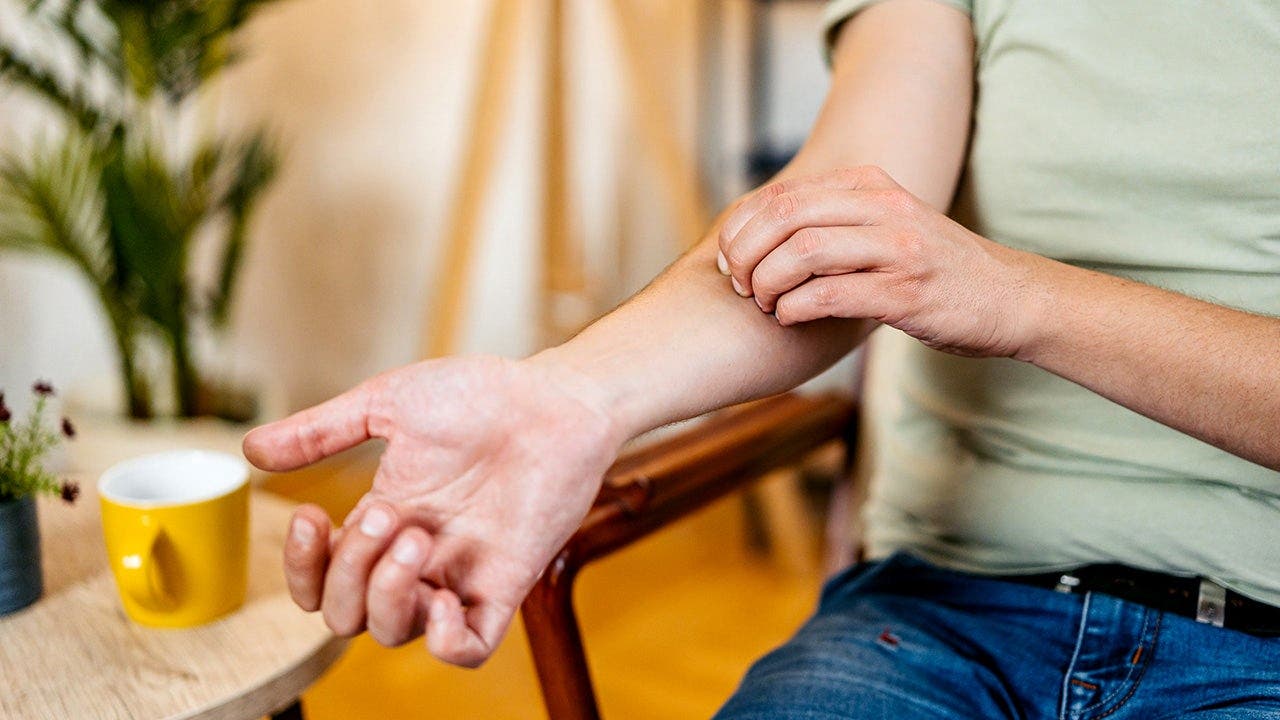 Scratching an itch can increase eczema and skin irritation, research shows