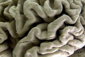 A blood test could forecast the onset of Alzheimer's symptoms years ahead of time.