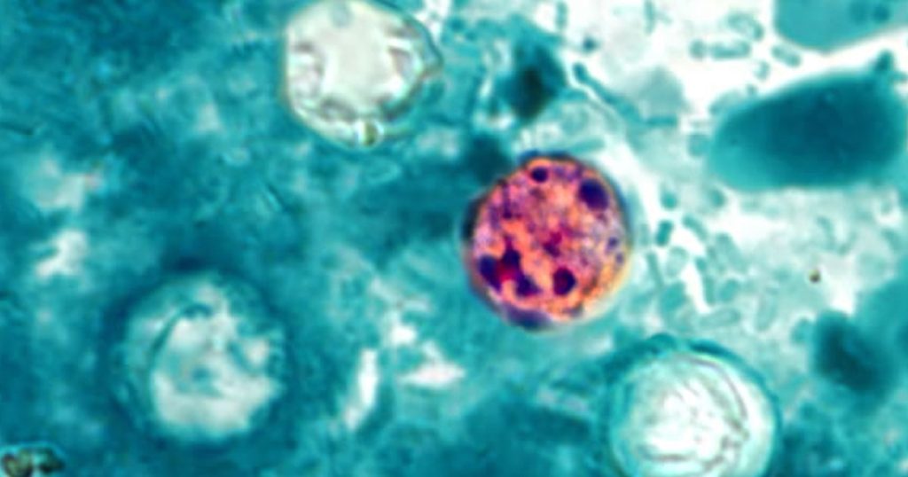 Almost 7,000 potential cases of cyclosporiasis reported across the country, CDC indicates