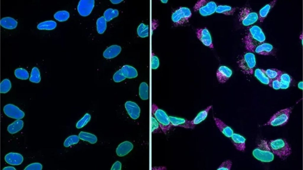 Alzheimer's Has Been Destroying Brain Cells in an Unexplained Manner