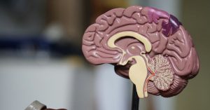 CO2 Therapies Might Eliminate Alzheimer's Proteins From the Brain