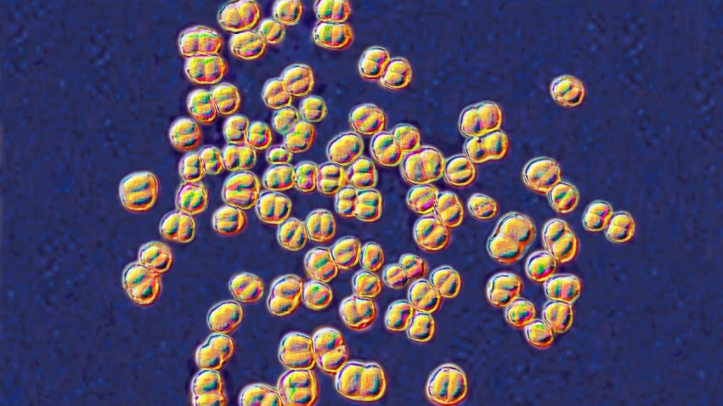 College lab course concludes with 32 individuals on antibiotics due to exposure to a dangerous germ.