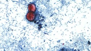 Cyclospora in Maryland: Cases have increased more than twofold since last week