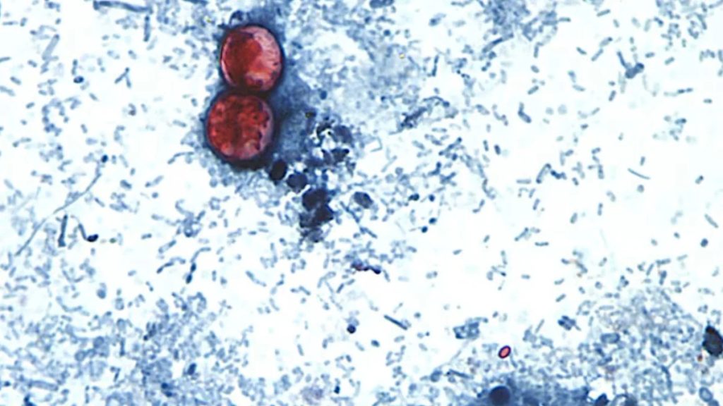 Cyclospora outbreak exceeds 1,700 cases in many states, with Michigan being the most affected. Should I be concerned?