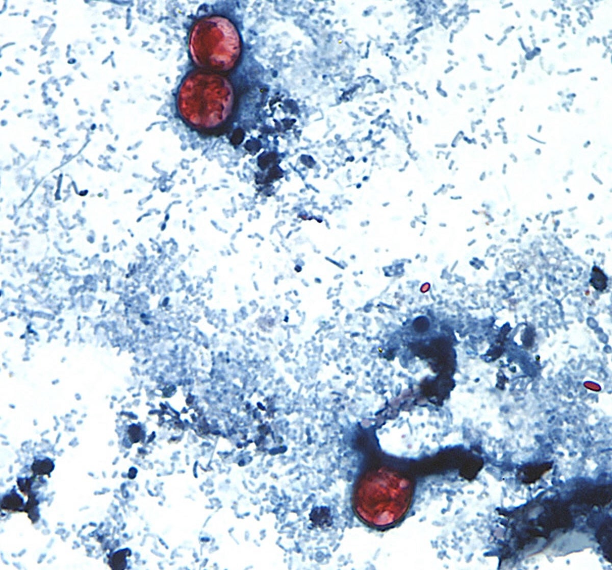 Cyclospora parasite in PA and NJ: What you should understand