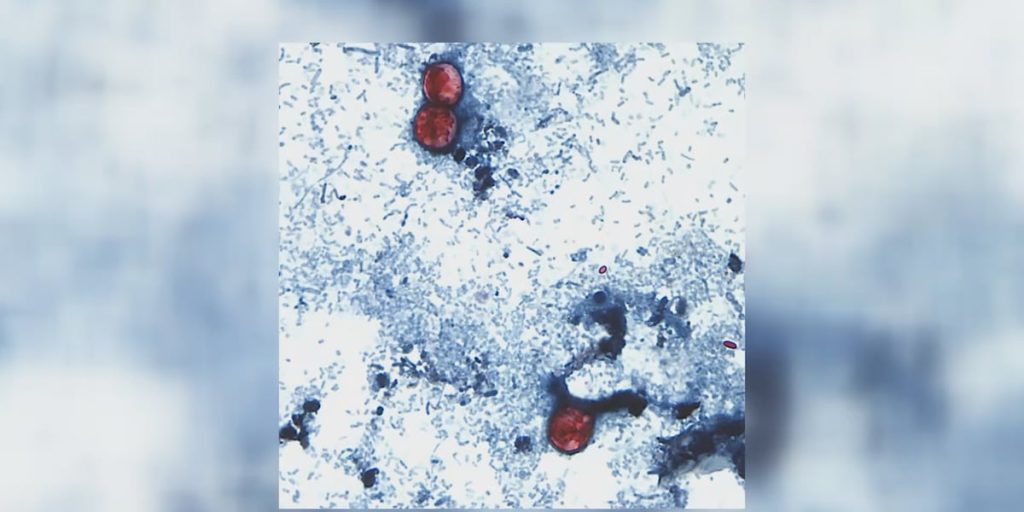 Cyclosporiasis outbreak in Michigan increases to around 700 cases