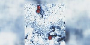 Cyclosporiasis outbreak in Michigan increases to around 700 cases