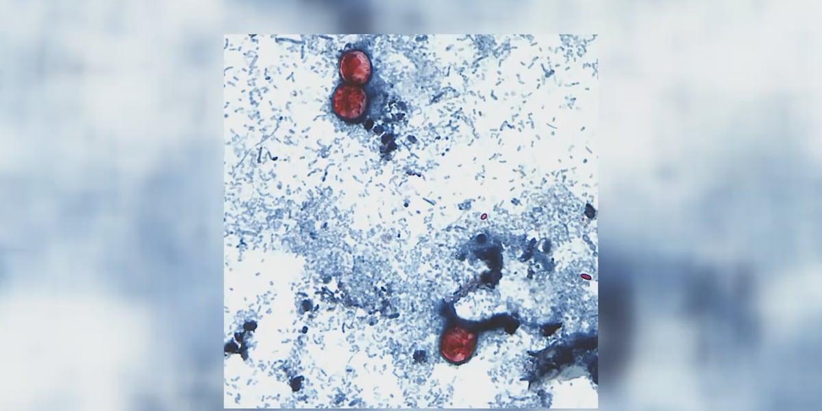 Cyclosporiasis outbreak in Michigan increases to around 700 cases
