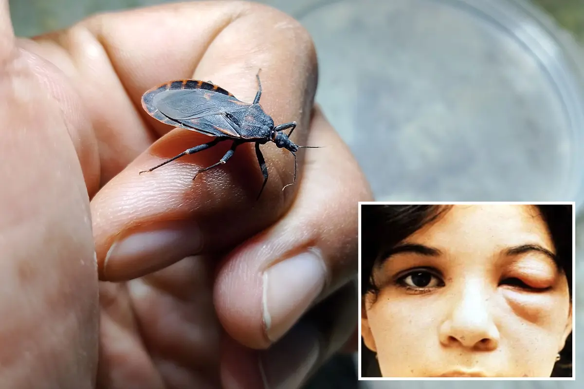 Deadly 'kissing bug' discovered in California, and those affected might be unaware
