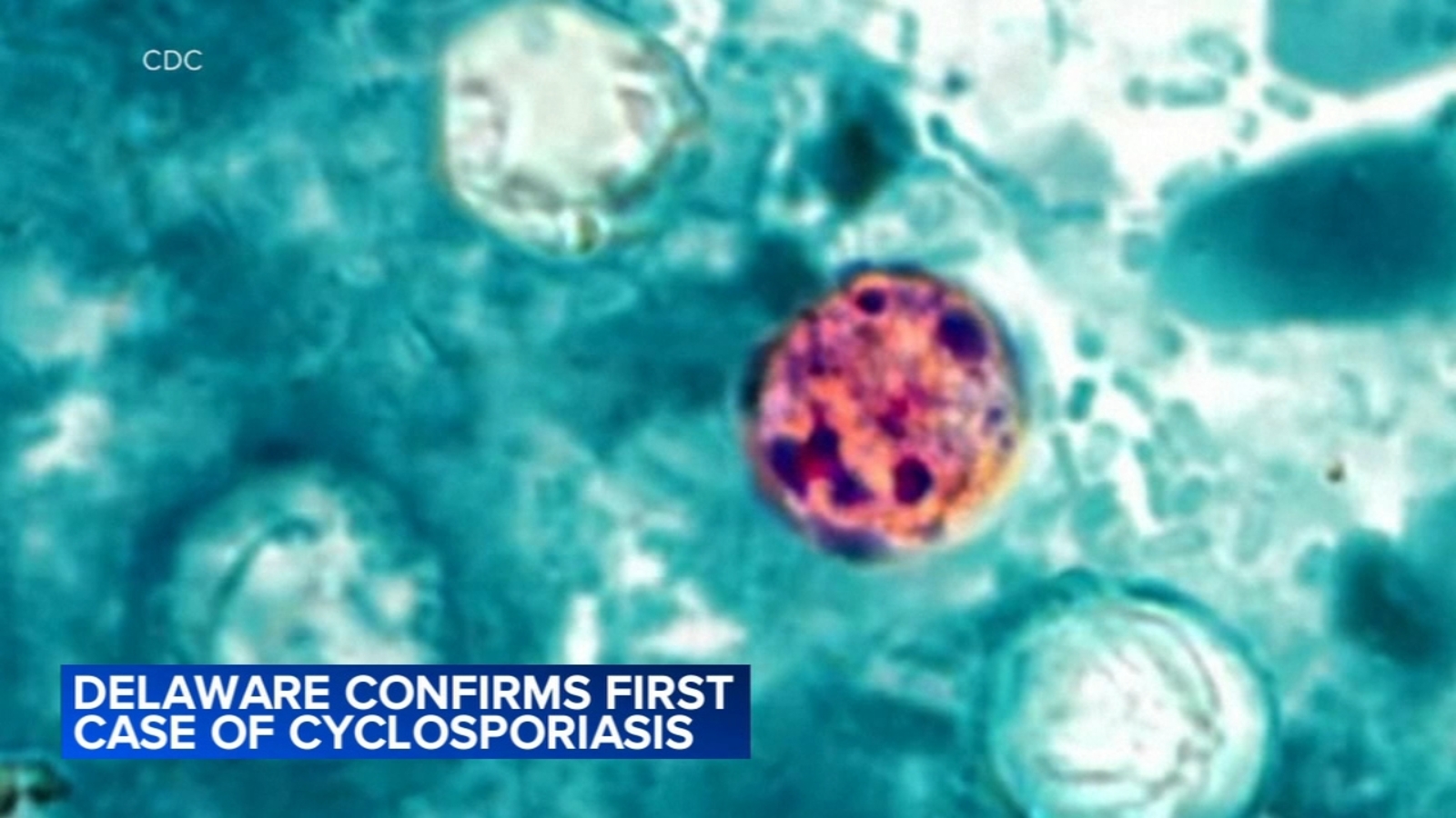 Delaware reports first instance of cyclosporiasis during parasitic outbreak