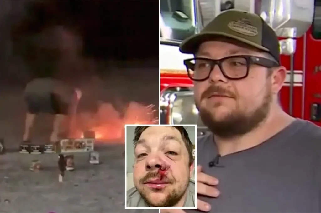 Father who is a firefighter hit by lightning in Alabama one year after a firework injured him