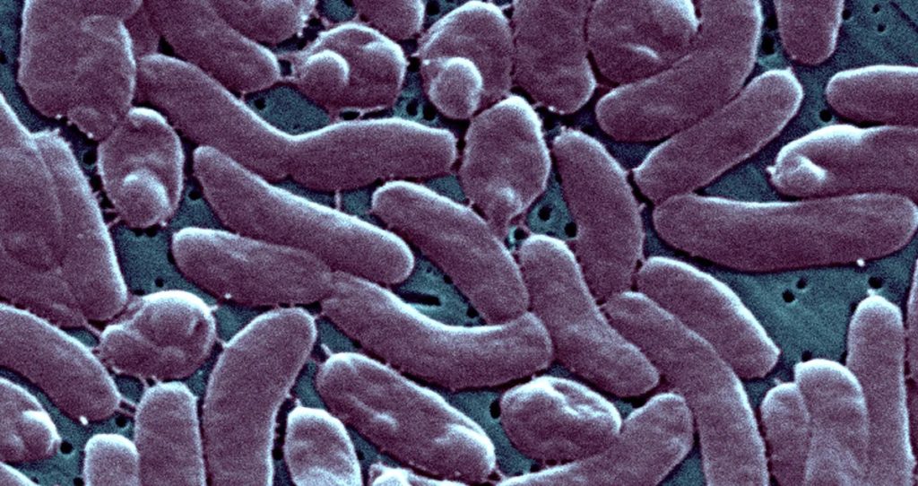 Florida sees first 2026 fatality from flesh-eating bacteria. Ways to minimize your chances of Vibrio vulnificus infection before eating or swimming in the ocean.