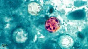 Foods linked to Cyclospora outbreak, findings from CDC data