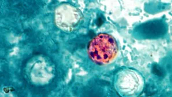 Foods linked to Cyclospora outbreak, findings from CDC data