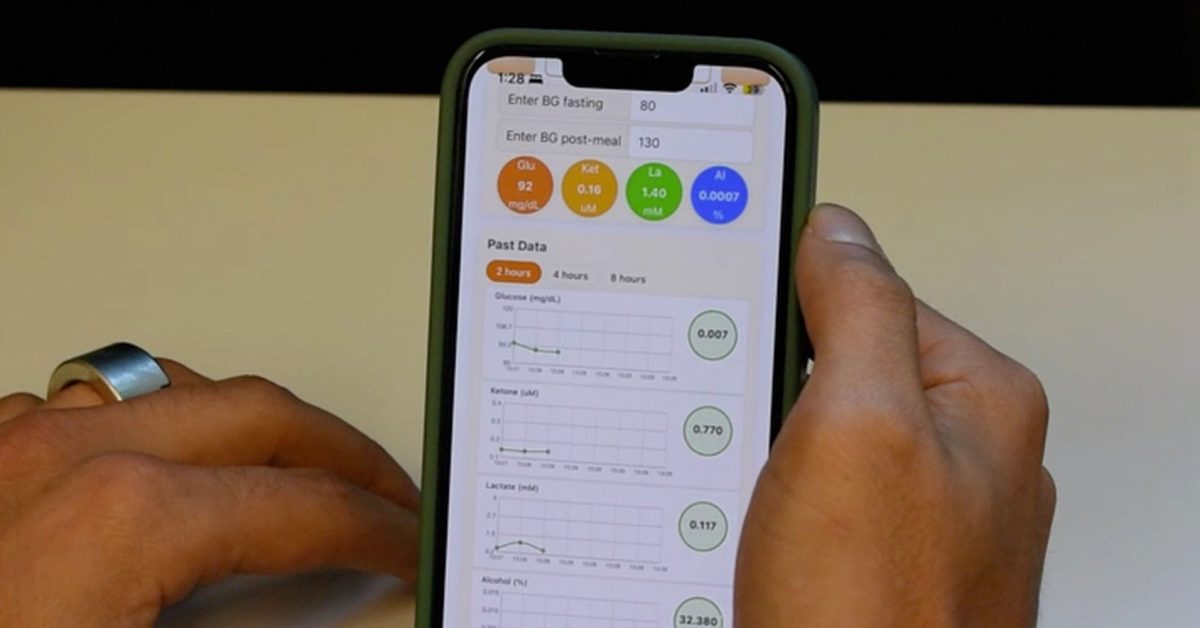 Innovative smart ring achieves breakthrough in non-invasive blood sugar monitoring