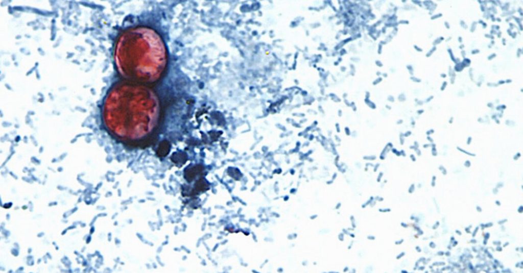 Insights from the Cyclospora Outbreak