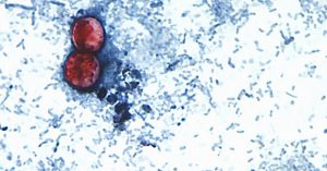 Insights from the Cyclospora Outbreak
