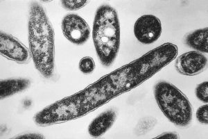 Key details about the Legionnaires' disease outbreak in New York City