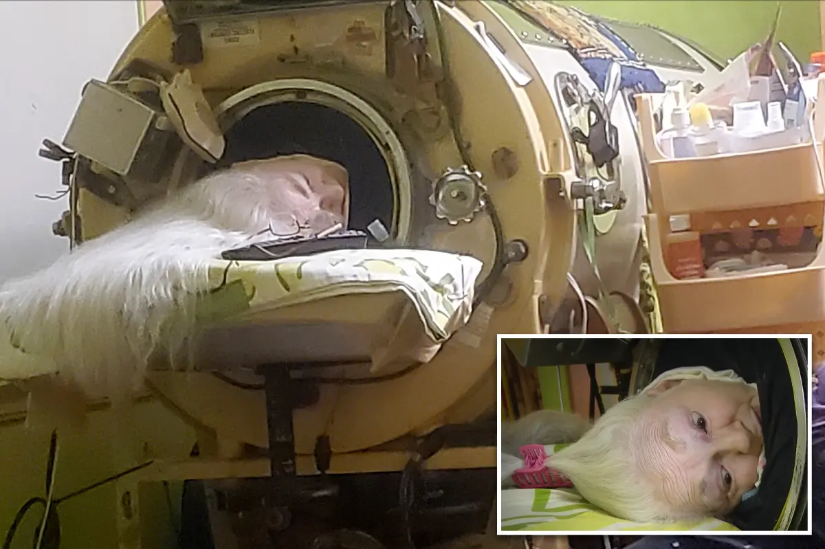 Martha Lillard, the final US polio patient reliant on an iron lung, has passed away at 78 in Oklahoma.