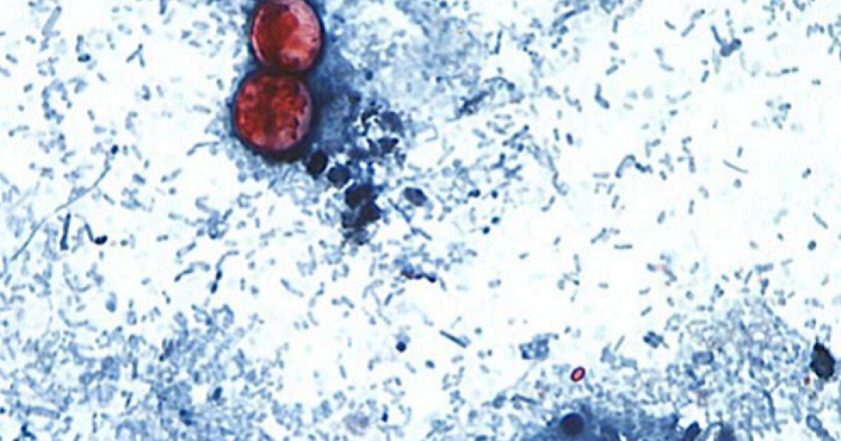 Missouri experiences rise in cyclospora infections.