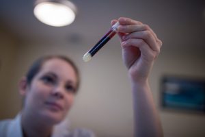 New blood test for Alzheimer’s can foresee symptoms a decade in advance