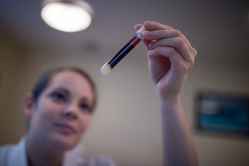 New blood test for Alzheimer’s can foresee symptoms a decade in advance
