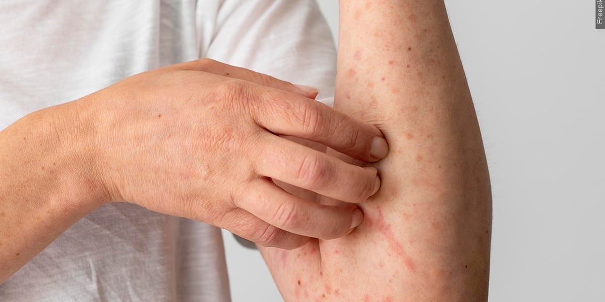 New locations for measles exposure in Maricopa County include Chase Field and Chandler mall